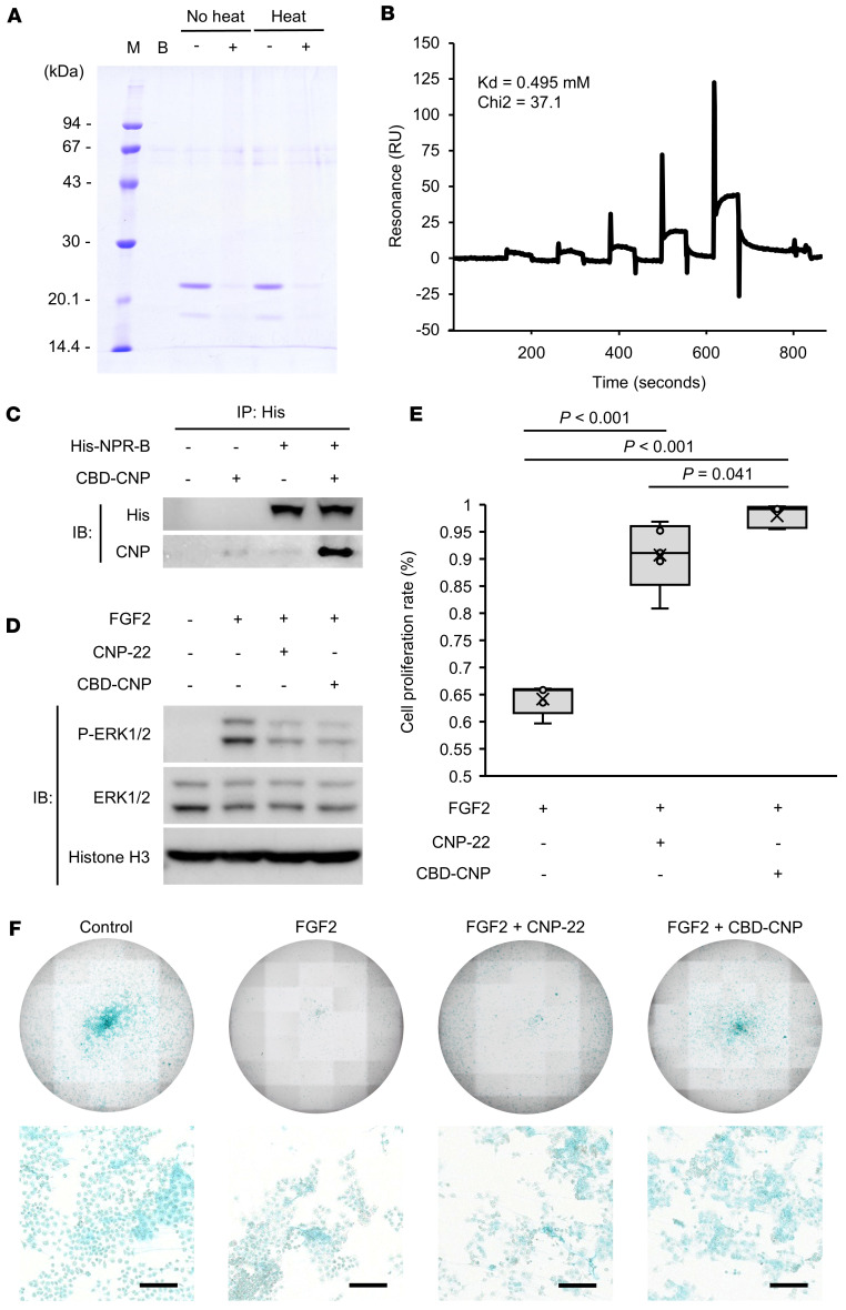 Collagen and ligand-receptor binding ability, and chondrocyte proliferation of CBD-CNP.(A) Collagen-binding ability and thermal stability of CBD-CNP. Unbound CBD-CNP was assessed by SDS-PAGE. M, molecular weight marker; B, buffer control; No heat, no preheating; Heat, preheating at 56°C 30 minutes; (–), no collagen powder was added; (+), collagen powder was added. (B) Surface plasmon resonance analysis of CBD-CNP binding to recombinant NPR-B immobilized on a CM5 chip. The Kd value was calculated from sensorgrams as described under the experimental procedures. (C) Ligand-receptor binding assay with CBD-CNP and NPR-B, the receptor for CNP. (D) Inhibitory effect of FGF2-FGFR3 downstream signaling pathway of RCS cells owing to the binding of CNP to NPR-B. Phosphorylation of ERK1/2 in RCS cells was assessed by FGF2 alone and combined treatment with CNP-22 or CBD-CNP. (E) Cell proliferation assessment of RCS cells after treatment with FGF2 alone or in combination with CNP-22 or CBD-CNP (n = 5). The cell proliferation rate was calculated based on the cell count with no drug treatment as 100%. (F) Alcian blue staining of RCS cells in each group. Scale bars: 200 μm in F. Statistical analysis was performed by using 1-way ANOVA followed by Tukey post hoc tests. SDS-PAGE, sodium dodecyl sulfate polyacrylamide electrophoresis; RU, response unit; IP, immunoprecipitation; IB, immunoblot; NPR-B, natriuretic peptide receptor B; CNP, C-type natriuretic peptide; FGF2, fibroblast growth factor 2; FGFR3, fibroblast growth factor receptor 3; RCS, rat chondrosarcoma; ERK, extracellular signal-regulated kinase; P-ERK, phospho-extracellular signal-regulated kinase.