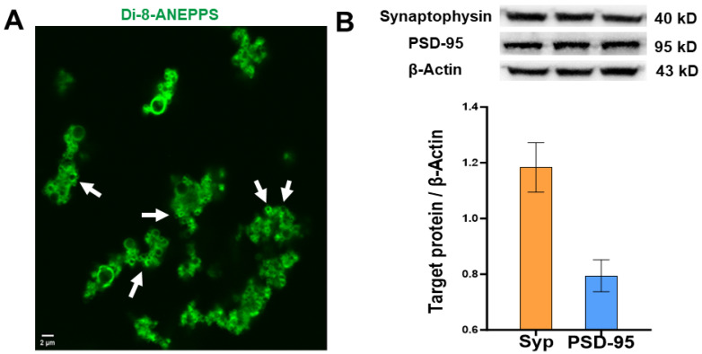 Characterization of synaptosomes obtained from the epileptic neocortex of patients with drug-resistant epilepsy. (A) Representative image of membrane stained with Di-8-ANEPPS. White arrows indicate synaptosome membranes. (B) Synaptophysin and PSD-95 protein expression relative to β-Actin in brain samples obtained from patients with drug-resistant epilepsy. The upper panels show representative Western blots of Synaptophysin, PSD-95, and β-Actin proteins of brain samples obtained from three patients.