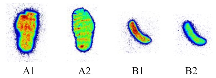 Autoradiography of rat (A) and mouse (B) spleen sections incubated with 0.6 nM [11C]KP23 in the absence of blocking agent (A1 and B1) or in the presence of excess blocking agent 1 μM GW4058233 (A2 and B2).