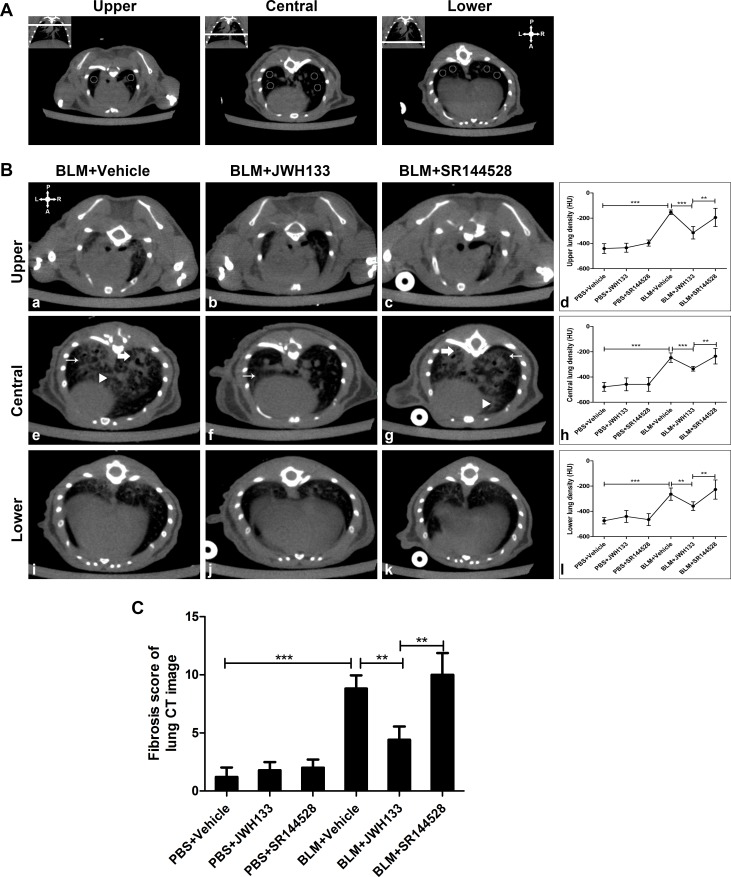 CB2R agonist JWH133 prevents BLM-induced computed tomography images of lung damage and fibrosis in mice(A) Lung density was expressed by Hounsfield units (HU) and 2 circles in the upper, 4 circles in the central and 4 circles in the lower region of the lung were measured. The upper-right symbol, gives the spatial position of posterior or dorsal (P), anterior or ventral (A), left (L) and right (R) regions. (B) Representative CT images of BLM administration mice at 21 days. Homographic slices, selected as described in figure (A), represent upper (a, b, c) central (e, f, g) and lower (i, j, k) pulmonary regions. Each slide of evaluation, including the following characteristic CT changes: ground-glass opacity (thin arrow), reticular pattern (bold arrow) and fibrosis stranding (triangle). Quantification of lung density in 6 group animals were assessed in upper (d) central (h) and lower (l) pulmonary regions. (C) Fibrosis score of mice lung CT image was also assessed. Image analysis was performed by two investigators independently and blindly. Graphs show mean ± SD of at least six mice for each group. *P < 0.05, **P < 0.01, ***P < 0.001.