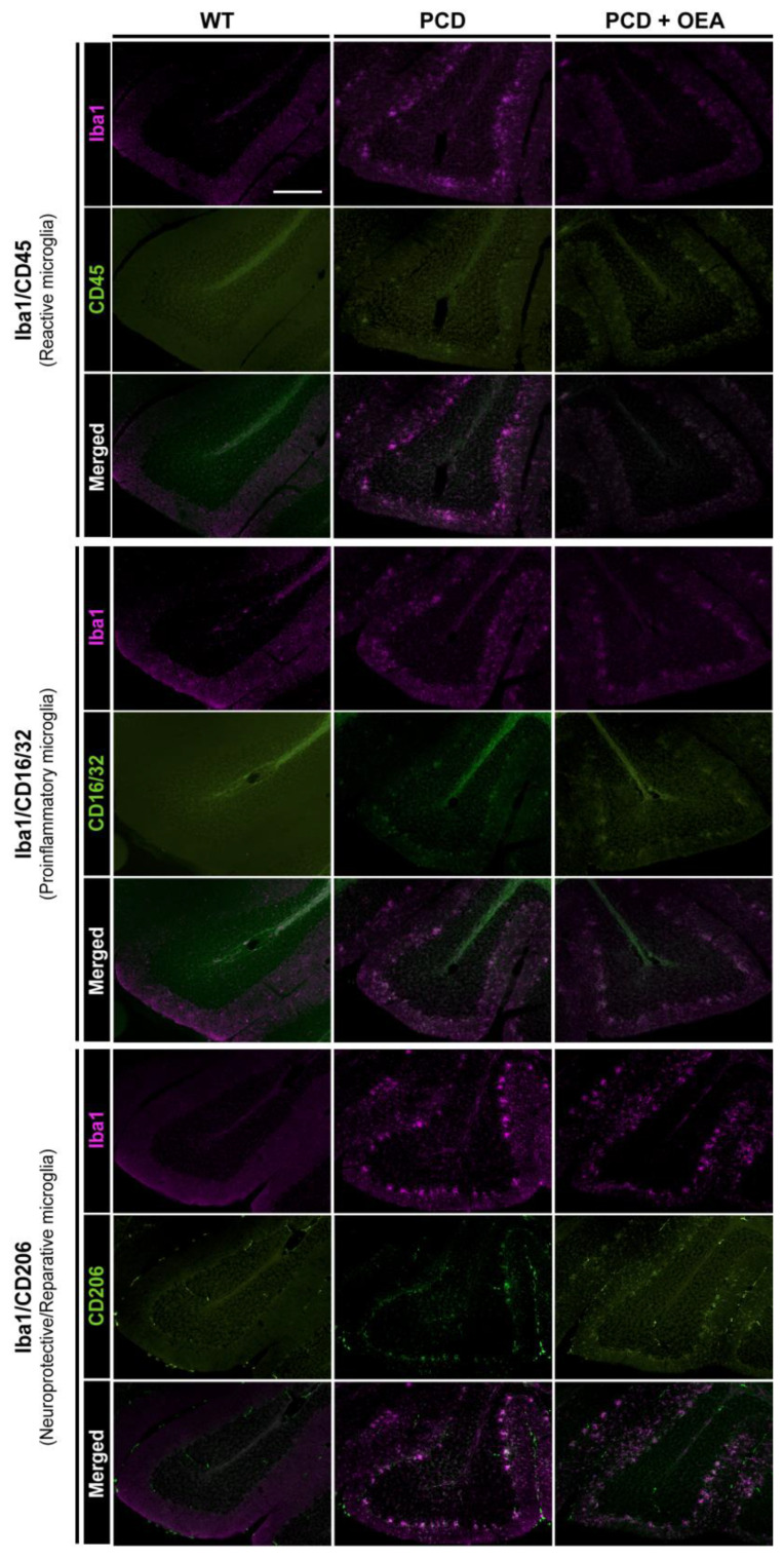 Marker-based characterization of microglia in the cerebellum of WT, PCD, and OEA-treated PCD mice at P30. At the (top), immunolabeling for Iba1 (magenta) and CD45 (green), i.e., reactive microglial cells. In the (center), immunolabeling for Iba1 (magenta) and CD16/32 (green), i.e., proinflammatory microglial cells. At the (bottom), immunolabeling for Iba1 (magenta) and CD206 (green), i.e., neuroprotective or tissue-reparative microglial cells. Overall, note the higher expression intensity of all the markers analyzed in PCD groups, both untreated and OEA-treated, compared to that of WT mice. Quantitative changes shown in Figure 5. Images in this figure are located in lobe VIII of the cerebellar vermis and presented at the same magnification. Scale bar: 100 µm. Adapted from [47].