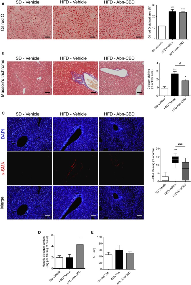 Effect of Abn-CBD on liver structure and function. Representative photomicrographs and quantification of livers stained for lipid droplets (A) and collagen fibers (B), scale bar is 100 μm. Representative photomicrographs of immunofluorescence in liver for α-SMA (red), counterstained with DAPI (in blue) (C). Biochemical determination of hepatic glycogen content (D) and circulating levels of alanine aminotransferase (E). n = 7–8 SD-Vehicle, n = 5–8 HFD-Vehicle and n = 6–8 HFD-Abn-CBD. *p ≤ 0.05 and ***p ≤ 0.001 compared to SD-Vehicle; #p ≤ 0.05 and ###p ≤ 0.001 compared to HFD-Vehicle.