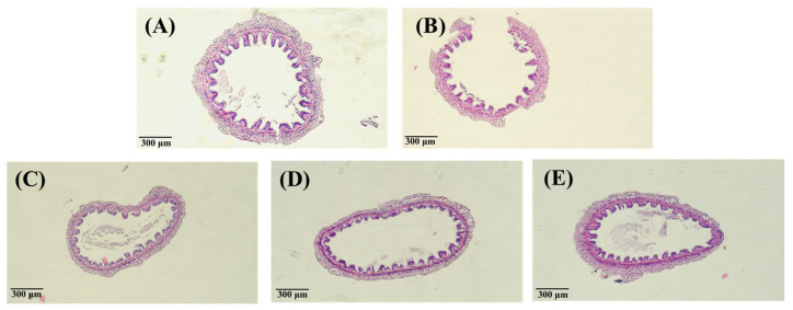Inverted micrographs of H&E-stained intestine of white shrimp that containing (A) control at 0 h; (B) control at 240 h; (C) injection 50 µg (g shrimp)−1 PNWE at 240 h; (D) injection 100 µg (g shrimp)−1 PNWE at 240 h; (E) injection 200 µg (g shrimp)−1 PNWE at 240 h. (100×).