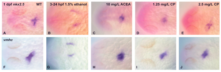 The effects of ethanol and cannabinoid exposure on the expression of other cardiac markers in embryonic zebrafish heart. The expressions of nkx2.5 (A–E) and vmhc (F–J) were examined in 1 dpf heart following ethanol or cannabinoid exposure from 3–24 hpf. Compared to the marker expression in untreated embryos (A,F), only exposure to 1.5% ethanol disrupts the normal cardiac marker expression pattern (B,G), with no effects of cannabinoid exposure on cardiac marker expression observed at any concentrations of these agonists (C–E,H–J). Each experiment was conducted in triplicate with an n = 20, with 60/60 embryos showing a normal nkx2.5 or vmhc expression pattern with no treatment or cannabinoid agonist exposure, and 0/60 embryos showing a normal marker gene expression pattern with ethanol exposure.