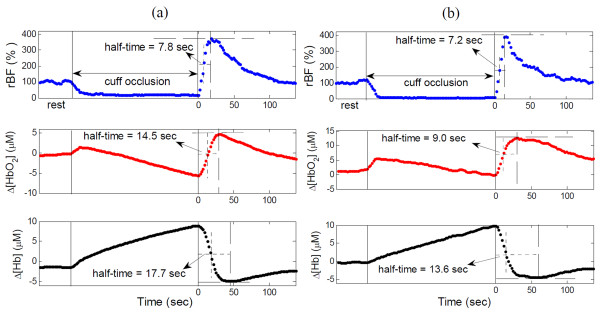 Illustrative recovery half-times of relative blood flow (rBF), change in oxyhemoglobin concentration (Δ[HbO2]) and change in deoxyhemoglobin concentration (Δ[Hb]) following arm cuff occlusion in (a) a subject with fibromyalgia (FM) and (b) a healthy control. The two solid vertical lines indicate the beginning and ending of cuff occlusion. The horizontal dashed and dotted lines indicate the maximal and half-maximal recovery values of hemodynamic variables, respectively. The vertical dotted lines indicate the recovery half-times.