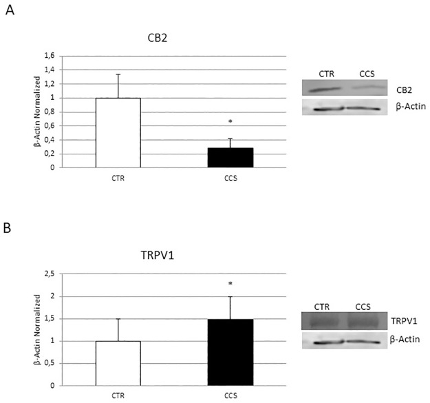 CB2 and TRPV1 expression in OCs derived from CCS.Protein expression of CB2 (A) and TRPV1 (B) in OCs from 5 Childhood cancer survivors (CCS) compared with OCs from 5 healthy subjects (CTR), determined by Western Blot starting from 15μg of total lysate. The most representative images are showed. The Image Studio Digits software has been used for the protein bands density detection. The intensity ratios of immunoblots compared to CTR, considered as 1, were quantified after normalization with the housekeeping protein β-Actin. Histogram shows the relative quantification for CB2 and TRPV1 expression as mean ± SD of independent experiments on each individual sample. For statistical analysis it has been used a t-test. *Indicates p ≤ 0.05 compared to CTR.
