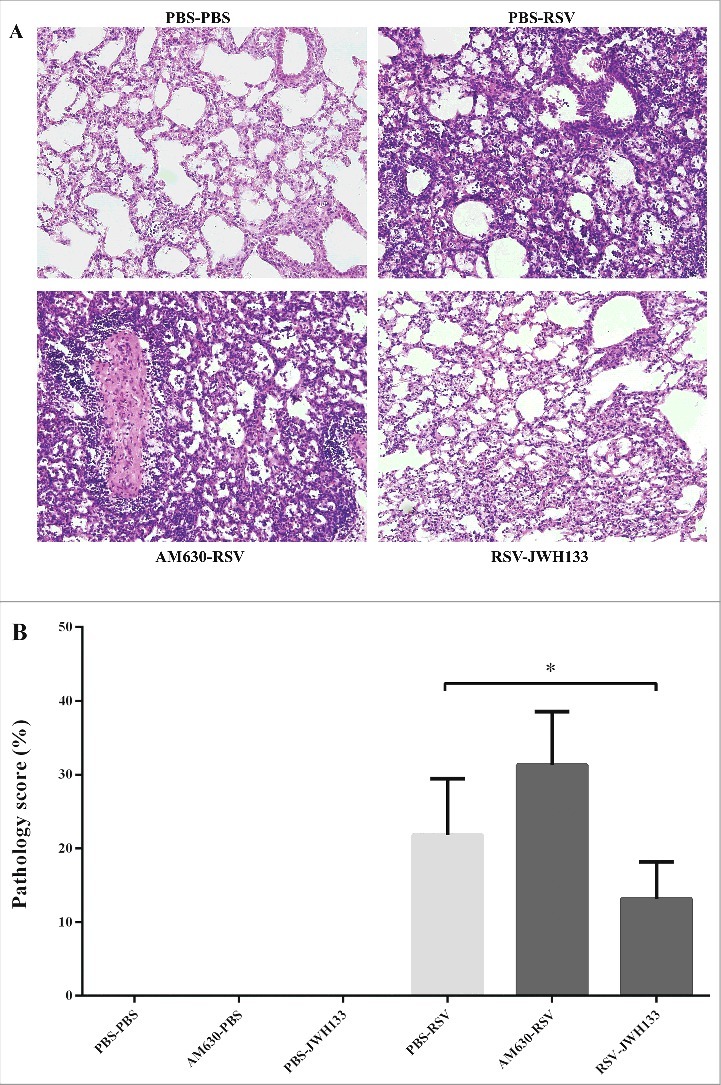The effect of CB2 receptors on lung pathology following RSV infection. CB2 receptors were blockade via using AM630 or activated through JWH133 daily and the lung pathology were determined on day 5 after infection. (A) Representative slides of hematoxylin and eosin-stained lungs were analyzed and scored on day 5 after infection. (B) Pathology scores percentage for each group are shown. Results represent the mean ±SEM of 6 animals for each group. (*p < 0.05).