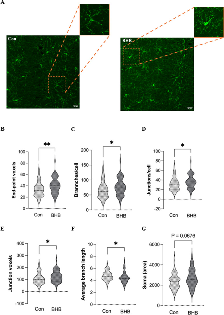 BHB treatment modified microglial morphology in the hippocampus of Obese mice. To assess the effect of BHB on microglial morphology in obesity-associated neuroinflammatory conditions, obese mice were treated with BHB, and hippocampal microglial morphology was analyzed by Iba-1 immunofluorescence and 3D morphological reconstruction. (A) Confocal microscopy images of microglia stained with Iba-1 antibody, showing microglia morphology; (B)# End-point voxels; (C) # Branches/cell; (D) # Junctions/cell; (E) # Junction voxels; (F) Average branch length; (G) Soma size. Con – control group, BHB – BHB treatment group. n = 6. For each animal, 10–15 microglial cells were analyzed. Data are presented as mean ± SEM; *p < 0.05; **p < 0.01