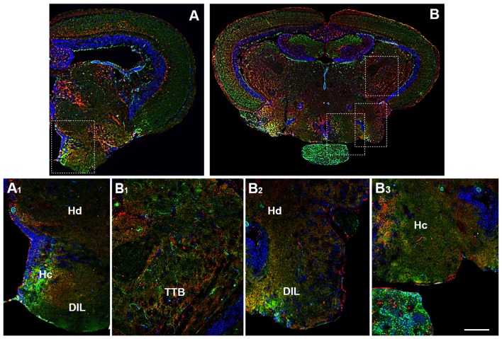 Distribution of OX-2R (red) and CB1R (green), and their co-localization OX-2R/CB1R (yellow) in coronal sections of diencephalon/mesencephalon. (A,B) OX-2R/CB1R co-expression has been observed in the dorsal (Hd) and central (Hc) zone of the periventricular hypothalamus, DIL and TTB. (A1) Higher magnification of the field boxed in (A) showing the OX-2R/CB1R co-expression within the Hc, Hd and DIL. (B1–B3) Higher magnification of the fields boxed in (B) showing the OX-2R/CB1R co-expression within the TTB (B1), Hd and DIL (B2), Hc (B3). DAPI (Blue) was used as a counterstaining to show nuclei. Scale bar, 250 μm for (A,B); 50 μm for (A1,B1–B3).