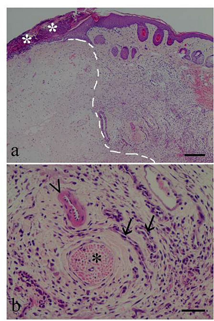 Skin photomicrographs from a male given β-caryophyllene 5 mg/kg (BCP5). (a) Low magnification (×40) showing the formalin injection site (left of the dotted line) and the inflammatory response area. Asterisks indicate a crust. (b) High magnification (×200) showing a nerve (asterisk), an arteriole (arrowhead), and two venules (arrows). The surrounding mononuclear inflammatory response was graded, as marked. Scale bars, 200 μm in (a) and 50 μm in (b).