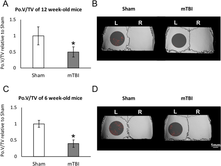 Calvarial porosity (PoV/TV) in the left parietal bone 10 days after mTBI on the right side in 12-week-old (A,B) and 6-week-old (C,D) ICR male mice. (A,C) PoV/TV mean ± SD in 9 animals per group; *p < 0.05 vs. sham-TBI. (B,D) Representative µCT images in the calvaria; ROI is shown as transparent gray; bone marrow spaces are shown in red.