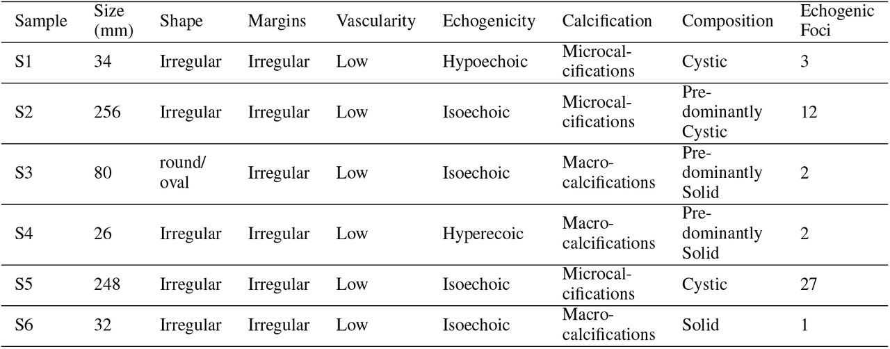 Few Important Ultrasonographic Features (Nodule)