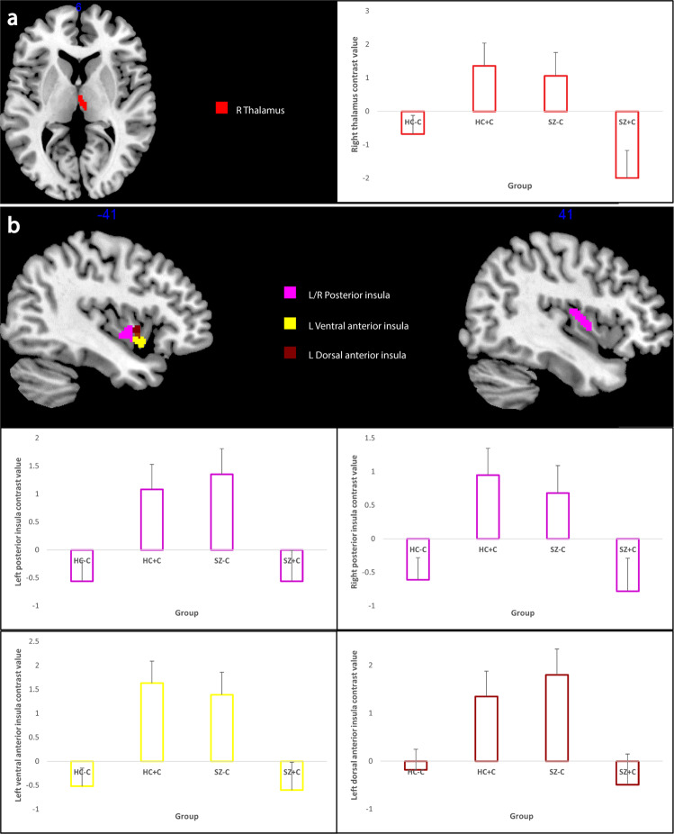 Main analysis.Clusters showing significant modulation by the interaction of cannabis and schizophrenia for the reward versus punishment contrast (a) and the magnitude contrast (b). Clusters thresholded at p < 0.005 for visualisation purposes. Red = thalamus; yellow = ventral anterior insula; brown = dorsal anterior insula; violet = posterior insula. The bar plots show mean beta values for each cluster for each group and error bars show standard errors of the mean beta values. HC−C non-cannabis user healthy controls, HC + C cannabis-user healthy controls, SZ−C non-cannabis user schizophrenia patients, SZ + C cannabis-user schizophrenia patients.