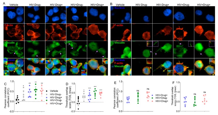 SE induced F-actin•Vinculin colocalization in monocytes. Representative 60× fluorescence images of U937 cells stained with phalloidin and vinculin to visualize (A) F-actin•Vinculin colocalization in adherence junctions. (B) F-actin•Vinculin colocalization in cell protrusions. Scale bar = 30 µm. Pearson correlation coefficient (PPC) and threshold overlap score (TOS, linear) plots corresponding to the images in Figure 8A,B for comparison of F-actin•Vinculin colocalization in adherence junctions (C,D) and cell protrusions (E,F). Purple arrows indicate vinculin in AJs (Figure 8A) or in areas of cell protrusion (Figure 8B). Yellow arrows indicate F-actin•Vinculin complex in AJs (Figure 8A) and areas of cell protrusions (Figure 8B). Ordinary one-way ANOVA (Dunnett’s correction) was used to assess statistical significance relative to vehicle. * p < 0.05, ** p < 0.01, *** p < 0.005, and ns, nonsignificant.