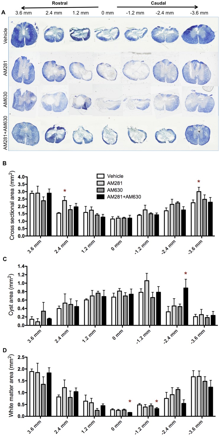 Early blockade of CB1 and CB2 receptors results in more tissue damage 90 days after lesion.(A) Eriochrome cyanine staining of representative spinal cords from vehicle-, AM281-, AM630- and AM281/AM630-treated rat at 90 days after lesion. (B) Quantification of the spinal cord cross sectional area shows no difference between vehicle-, AM630- and AM281/AM630-treated rats. An increase in the cross-sectional area of AM281-treated rats is observed at 2.4 mm rostral and 3.6 mm caudal to the epicentre (C) Evaluation of cyst area reveals that the cyst in AM281/AM630-treated rats remains bigger caudally to the epicentre. (D) In addition, AM281/AM630-treated rats present less white matter preservation at the epicentre and adjacent caudal region. *p<0.05 vs. vehicle. Vehicle n = 6; AM281 n = 6; AM630 n = 5; AM281+AM630 n = 5.