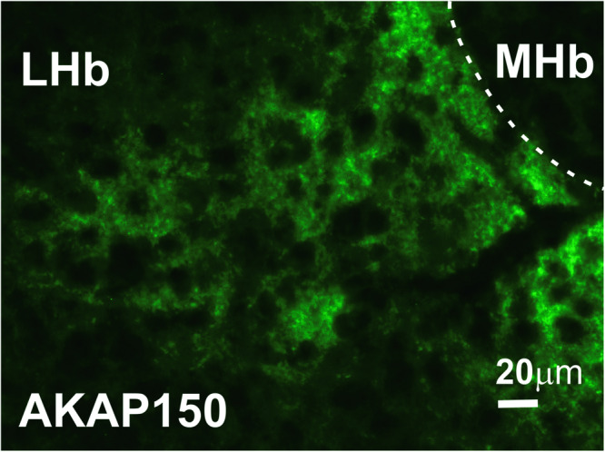 AKAP150 is expressed in the LHb.Example of a brain section stained with antibody to AKAP150 (green), showing the expression of AKAP150 in the mouse LHb. Scale bar, 20 μm.