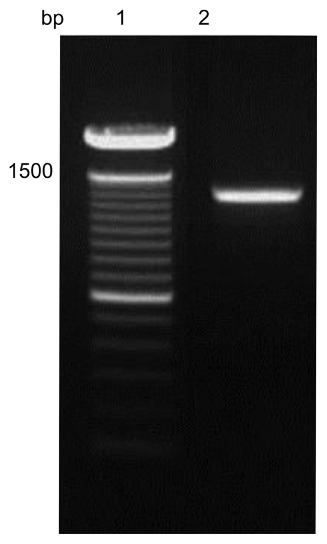 CB1 gene identification by PCR after transformation into Pichia pastoris. Lane 1: size marker, lane 2: transformed pPICZαC-CB1. The gene was analyzed after selection on minimal methanol histidine and minimal methanol dextrose media. The CB1 gene size is 1,416 bp.