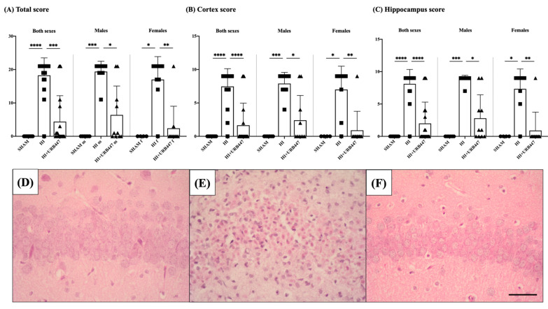 Effect of HI and URB447 on neuropathological score of total brain (A), cortex (B) and hippocampus (C). Data analysis was first performed in both sexes together and then in males and females separately. Non-treated HI animals showed the highest scores, whereas subsequent URB447 treatment restored scores to sham-like values in all cases. * p < 0.05; ** p < 0.01; *** p < 0.001; **** p < 0.0001 vs. HI. Representative microphotographs of the CA1 area of the hippocampus from sham (D), HI- (E) and HI+URB447-treated (F) animals. H&E staining. All images were taken at 40× magnification. Scale bar: 50 μm.