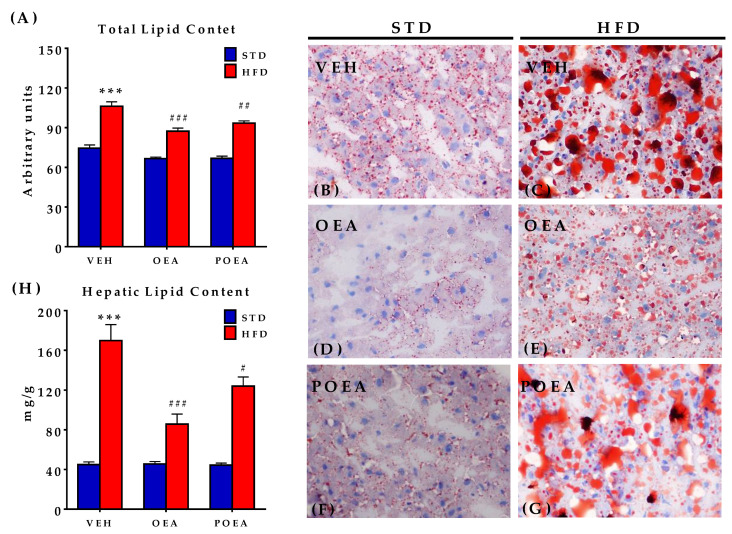 Effect of sub-chronic (15 days) administration of a 10 mg/kg dose of either oleoylethanolamide (OEA) or palmitoleylethanolamide (POEA) in liver in hypercaloric cafeteria diet (HFD) male Sprague–Dawley rats on hepatic lipid content (A) in standard diet (STD) and HFD, and corresponding representative images of liver fat content with oil red O staining, taken under a microscope with 40× objective (B–G). (H) Measurement of the total fat content in liver. Bars are means ± standard error of the mean SEM per group (n = 6 samples per group) analyzed by two-way ANOVA (diet and treatment, with Bonferroni post-hoc test). (***) p < 0.001 significant differences compared with STD vehicle (VEH) group; (#) p < 0.05, (##) p < 0.01, and (###) p < 0.001 significant differences compared with HFD VEH group.