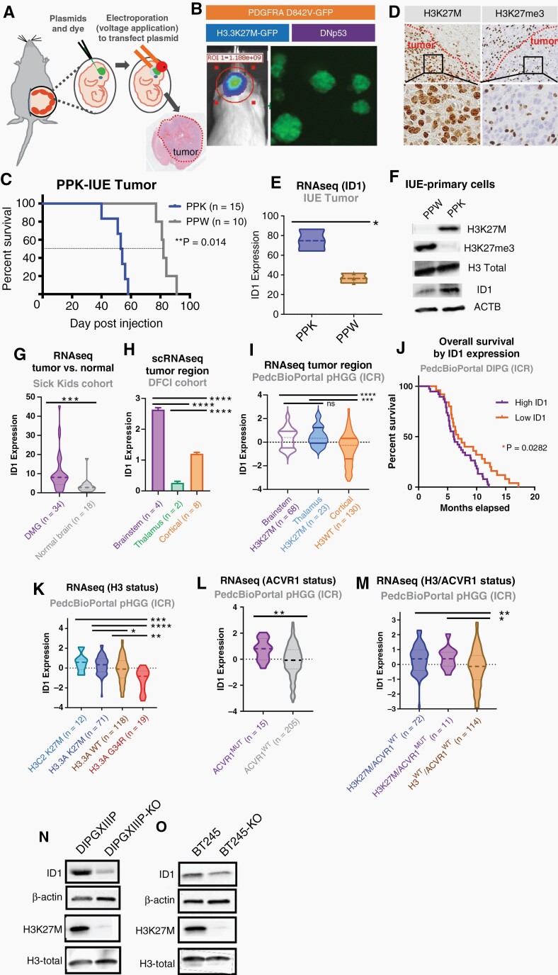 Elevated expression of ID1 in DIPG population. (A) IUE-mediated H3K27M-tumor model. (B) PDGFRAMUT-p53MUT-H3WT (“PPW”) and PDGFRAMUT-p53MUT-H3K27M (“PPK”) tumors generated by IUE. Tumor growth monitored by in vivo bioluminescence imaging and primary neurosphere cell cultures generated by dissociation of tumor tissue. (C) Survival curve for PPW and PPK mice; **P = .014, log-rank test. (D) IHC-stained images of PPK tumor for H3K27M and H3K27me3 expression (representative of n = 3 tumors). Magnification = 10× (top row); 40× (bottom row). (E) ID1 expression by RNA-sequencing from PPK and PPW from IUE mouse tumors, *P < .01, Welch’s t-test. (F) Western blot (WB) of PPW and PPK primary neurospheres for assessment of H3K27M, H3K27ac, and ID1 expression by H3-K27M mutational status. (G) ID1 expression of DIPG tissue (n = 34) compared to matched normal brain tissue (n = 18) from SickKids cohort; ***P < .001, unpaired parametric t-test. (H) ID1 expression by scRNA-seq from DFCI cohort, including brainstem, thalamus, and cortex; ****P< .0001, one-way ANOVA t-test. (I) ID1 expression of DMG tissue compared to hemispheric pHGG tissue from ICR cohort; ****P < .0001, unpaired t-test. (J) Kaplan–Meier survival curve of DIPG patients (n = 66) grouped by high and low ID1 expression. *P = .0282, Mantel–Cox test. (K) ID1 expression across H3.1 (H3C2) K27M (n = 12), H3.3 (H3.3A) K27M (n = 71), H3WT (n = 118), and H3.3 (H3.3A) G34R/V (n = 19) DIPG tumors from ICR cohort, presented in Mackay et al.; *P < .05, **P < .01, ***P < .001, ****P < .0001, one-way ANOVA t-test. (L) ID1 expression of pHGG tissue by ACVR1 mutational status (n = 15 ACVR1MUT; n = 205 ACVR1WT). Data from ICR cohort; **P < .01, unpaired parametric t-test. (M) ID1 expression of pHGG tumors with H3K27M only (n = 72), H3K27M, and ACVR1 mutations (n = 11) and neither mutation (H3WT/ACVR1 WT; n = 114) from ICR cohort; *P < .05, **P < .01, one-way ANOVA t-test. (N–O) WB showing removal of H3K27M in two human DIPG cell lines (DIPGXIIIP* and BT-245) decrease ID1 expression.