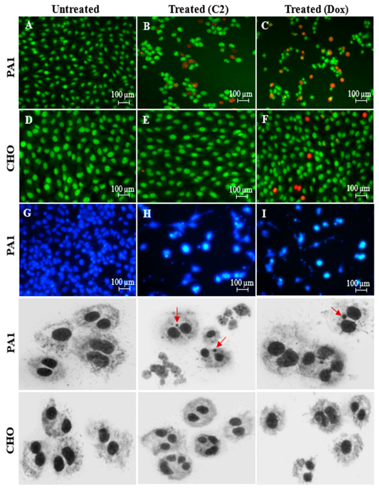 PA1 cell lines were treated with C2 (IC50 1 µg/mL (1.7 µM)) and a reference drug, doxorubicin (IC50 5 µg/mL (8.6 µM)). Acridine orange/propidium iodide-stained (A–F) and DAPI-stained (G–I) cells in epifluorescent microscope view show apoptotic bodies (red), while the CHO cells were found healthy upon C2 treatment. Micronuclei formation (red arrows) was seen for C2- and doxorubicin-treated PA1 cells at 20× in an Axioscope A1 Biology Microscope which is not visible for CHO, indicating C2 is not genotoxic in non-cancerous cell lines.