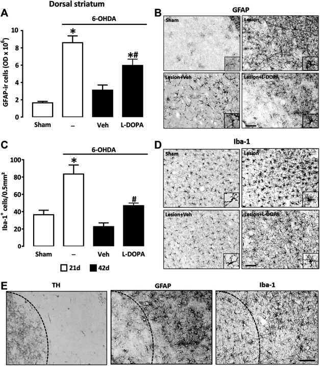 Quantification of the glial reaction in the dopamine-denervated dorsal striatum of mice receiving L-DOPA. (A) Intensity of the astroglial reaction evaluated by quantification of the GFAP immunosignal in the dorsal striatum of sham-operated and 6-OHDA-lesioned mice sacrificed at day 21 or at day 42 after stereotaxic surgery. Mice sacrificed at day 42 received Veh or L-DOPA treatment between days 21–42. *p < 0.05 vs. sham; #p < 0.05 vs. Veh, n = 7; One-way ANOVA followed by Bonferroni test. (B) Micrographs depicting GFAP+ cells in the dorsal area of the striatum of the same groups as before. Note profound changes in the number of GFAP+ astrocytes and in their morphology 21 days after 6-OHDA injection. At day 42, the astrocyte reaction is reduced but still intense in 6-OHDA-lesioned mice treated with L-DOPA. (C) Intensity of the microglial reaction was evaluated by quantifying the density of Iba-1+ cells in the dorsal striatum of the same groups as before. *p < 0.05 vs. sham; #p < 0.05 vs. Veh, n = 7; One-way ANOVA followed by Bonferroni test. (D) Micrographs depicting Iba-1+ cells in the dorsal area of the striatum of the same groups as before. Note that the microglial reaction is prominent in 6-OHDA-lesioned mice 21 days after stereotaxic surgery. At day 42 the microglial reaction is reduced but still present in L-DOPA-treated mice. (E) Immunocytochemical detection of TH, GFAP and Iba-1 in the dorsal striatum of 6-OHDA-lesioned mice treated with L-DOPA between day 21 and 42. Illustrations show that the glial reaction is restricted to the dorsal striatum where TH immunostaining is reduced. Dash lines represent the virtual boundary between the dorsal and ventral striatum. Micrographs for GFAP and Iba-1 are from slides at level +0.1 mm and +0.18 mm from Bregma, respectively. Scale bar: 100 µm.