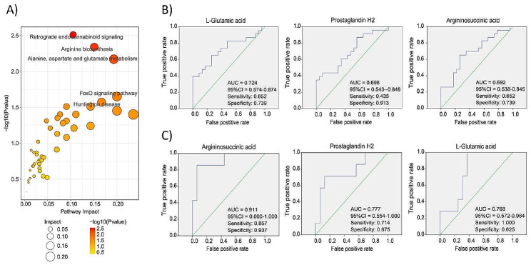 Abnormal metabolic pathways in two groups and ROC curves of related metabolites. (A) KEGG pathway of differentially expressed metabolites. (B) The ROC curve of 3 differential metabolites discriminating the gastric cancer tissues from normal tissues. (C) The ROC curve of 3 differential metabolites discriminating gastric cancer tissues located in middle third stomach from gastric cancer tissues located in upper/lower third stomach. ROC, Multivariate receiver operating characteristic; AUC, area under the curve; 95%CI, 95% confidence interval