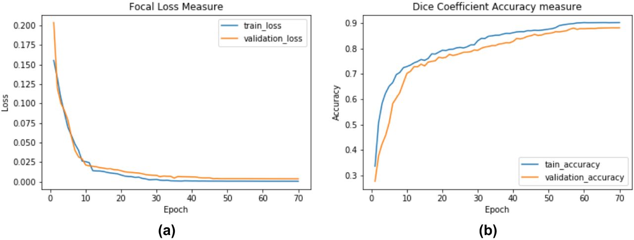Sample learning curves, for Model M3, over training and validation sets; (a) loss: FL, and (b) accuracy: DSC