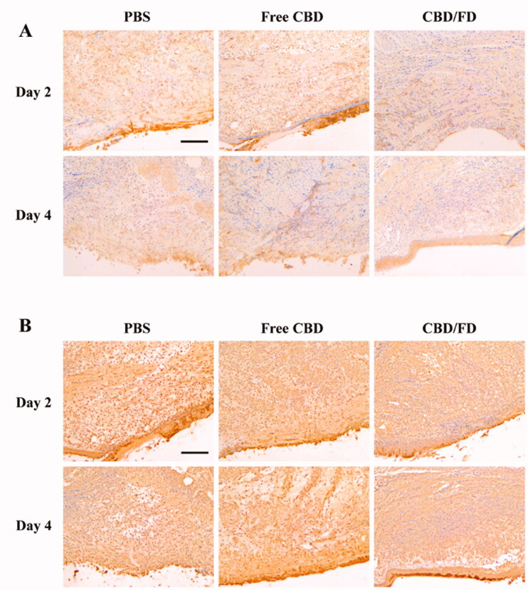 Immunohistochemical staining of (A) Ly6G cells and (B) NF-κB p65 in tongue ulcers after intravenous administration of CBD/FD nanomicelles. Scale bar, 100 μm.+