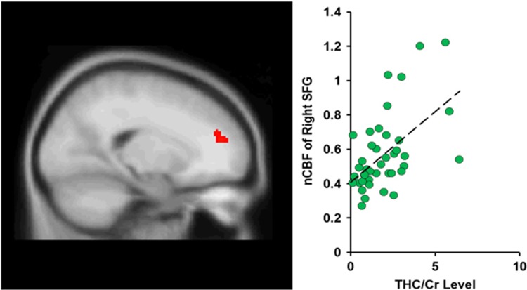 The cannabis users showed a significantly positive association between right superior frontal cortex cerebral blood flow and THC/Cr level (p<0.05, FWE corrected).