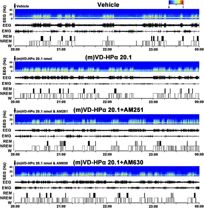 Effects of AM251 and AM630 co-injection with (m)VD-HPα on the EEG and sleep–wake states. Representative 4-h (20:00–00:00) EEG power spectra (frequency 0–30 Hz), EEG, EMG, and hypnograms in rats treated with vehicle, 20.1 nmol of (m)VD-HPα, and 20.1 nmol of (m)VD-HPα with AM251 or AM630 are shown. It should be noted that the rat injection of (m)VD-HPα had a reduced NREM sleep latency and displayed an increase in NREM sleep accompanied by increased cortical 0.5–4.0 Hz activities and suppressed cortical 14.5–30 Hz activities. The rat co-injection of (m)VD-HPα with AM251 [(m)VD-HPα 20.1 + AM251] but not AM630 [(m)VD-HPα 20.1 + AM630] showed a prolonged NREM sleep latency and increased wakefulness accompanied by decreased cortical 0.5–4.0 Hz activities and increased beta activities.
