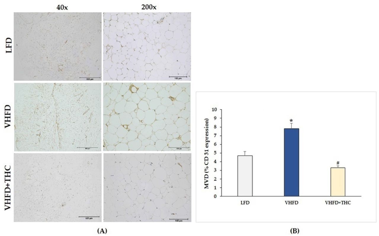Effect of THC on adipose angiogenesis in VHFD-induced obese mice:(A) Representative CD31 expression; left column, magnification 40×; scale bar = 500 μm; right column, magnification 200×; scale bar = 100 μm; (B) MVD (% CD31 expression). Data are presented as mean ± SEM. *p < 0.001 vs. LFD group; #p < 0.001 vs. VHFD group.
