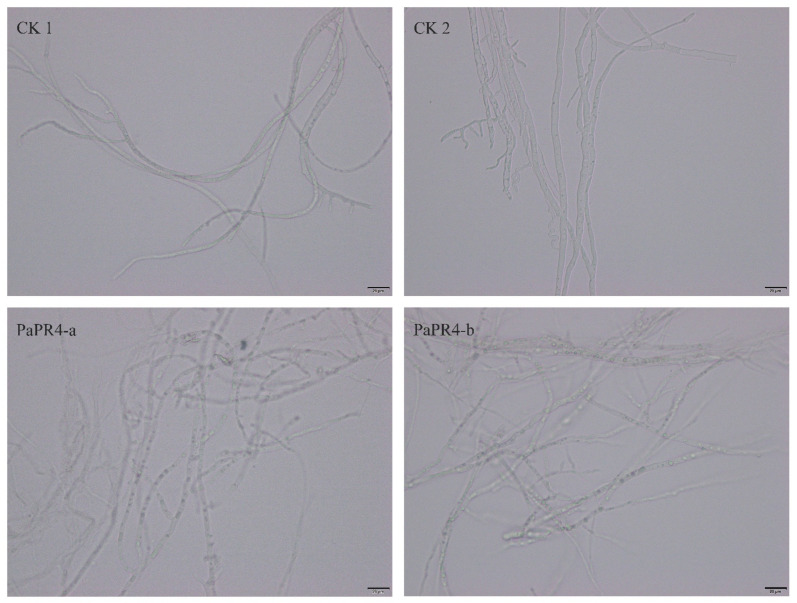 Antifungal activity of recombinant PaPR4-a and PaPR4-b proteins.CK1 and CK2 represent mycelia treated with sterile water and eluent, respectively, while PaPR4-a and PaPR4-b represent the experimental groups. Each experiment was performed in triplicate. The scale bar in the figure is 20 μm.