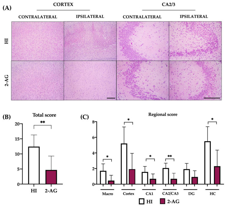Treating animals with 2-AG results in lower neuropathological score values at P14. (A) Representative microphotographs of the contralateral and ipsilateral cortex and CA2/3 regions of non-treated HI and 2-AG treated animals. Cortex images were taken at 10× magnification (Scale bar: 200 μm). CA2/3 images were taken at 20× magnification (Scale bar: 100 μm). (B) Global neuropathological score revealed significant (** p < 0.01) reduced damage in 2-AG-treated rat pups. (C) Regional neuropathological scores were performed macroscopically (macro), in the cortex, in the CA1, CA2/3, and dentate gyrus (DG) areas of the hippocampus, and in the whole hippocampus (HC). Scores were higher in non-treated HI animals than in 2-AG treated animals in all regions, but differences were only significant in the cortex (* p < 0.05), CA2/3 region (** p < 0.01), and whole hippocampus.