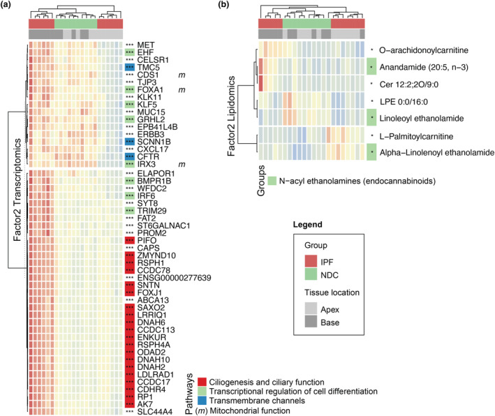 In‐depth characterisation of Factor2. (a) Heatmap representing the top 50 genes with the highest loading values for Factor2, associated with disease progression. Each row represents a gene (z‐score of normalised gene expression) and each column a sample. (b) Corresponding heatmap for lipids. Each row represents a lipid (z‐score of normalised lipids intensities). Column annotations depict disease groups and lung tissue locations. Row annotations refer to literature‐based pathways for transcriptomics and broad lipid classes for lipidomics. Sample sizes are 6 IPF apex, 6 IPF base, 5 NDC apex and 5 NDC base. Statistics represent the result of FDR‐corrected limma differential gene expression testing for transcriptomics and lm for metabolomics and lipidomics with FDR < 0.05, < 0.01 and < 0.001 represented as *, ** and ***, respectively.