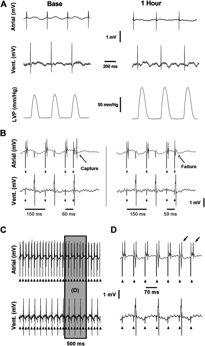 Example recordings from the ex vivo experimental setup. (A) Baseline (left) and 1 h (right) recordings demonstrating the atrial and ventricular electrical signals and LVP signal used to evaluate the effects of CB-13 under standard conditions without pacing. (B) Conventional S1S2 programmed stimulation protocol applied using a quadripolar electrode attached to the right atrium. Left, Atrial capture following S1S2 of 60 ms. Right, Failure of atrial capture following S1S2 of 59 ms. (C) Continuous assessment of atrial and ventricular signals during atrial tachypacing study. (D) Enlarged segment of the recording in C demonstrating the clear and precise ability to determine 1:1 atrial capture during the tachypacing protocol used in this study. Note beat-to-beat oscillation in the shape of the atrial signal (alternans) often observed when the fast pacing cycle length was reaching the minimal value that was able to maintain 1:1 atrial capture.