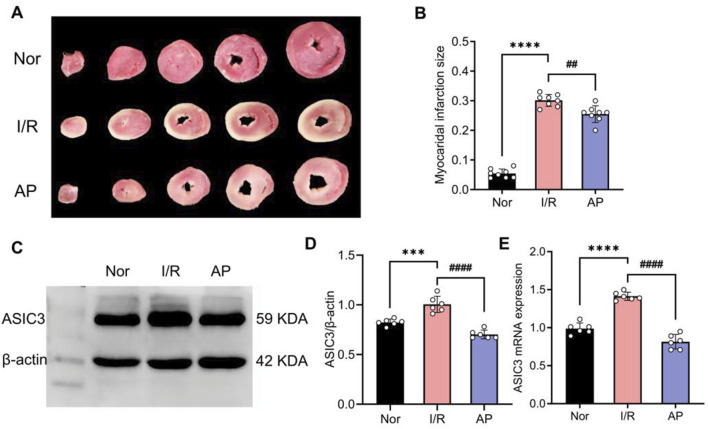 APETx2 post-conditioning inhibits ASIC3 expression and reduces myocardial infarct size. (A) Myocardial infarct size was observed using TTC staining. Compared to the Nor group, myocardial infarct size significantly increased in the I/R group after MIRI, whereas APETx2 post-conditioning significantly reduced the infarct size (n = 3 per group). (B) Quantification of myocardial infarct size. Infarct size was calculated using ImageJ software. (C) ASIC3 protein expression in rat myocardial tissue. Post-conditioning with the ASIC3 antagonist APETX2 (630 nM) inhibited ASIC3 protein expression in MIRI rats (n = 6 per group). (D) Quantification of ASIC3 protein expression. (E) ASIC3 mRNA expression in rat myocardial tissue. APETx2 inhibited ASIC3 mRNA expression in MIRI rats (n = 6 per group). One-way ANOVA, *P < 0.05; **P < 0.01; ***P < 0.001; ****P < 0.0001. All data are presented as mean ± SEM