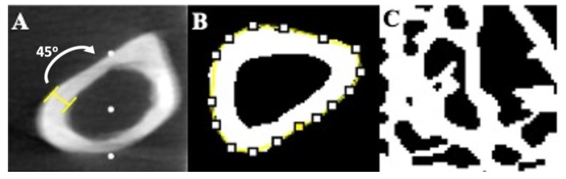 Representative micro-computed tomography images of femur and L5 centrum. (A) Femur Ct.Th measured at the mid-diaphysis as the distance between periosteal (outer) and endosteal (inner) bone surfaces using unaltered images. (B) Femur Ct.Ar/Tt.Ar values were obtained by making the image binary, where all bone material is made white and non-bone material is made black. An ROI (yellow) is then placed around the periosteum and Ct.Ar/Tt.Ar is measured as the fraction of white pixel to black pixel. This is repeated for every cross-sectional image within the mid-diaphysis region. (C) All trabecular bone measurements (BV/TV, Conn.D, Tb.Th, Tb.Sp) were obtained by isolating a square ROI containing only cancellous bone within the L5 centrum and making the image binary.