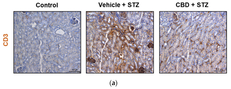 CBD significantly reduces but does not prevent STZ-induced immune cell infiltration in the kidney. (a) Representative images of immunostaining for CD3 cells in the kidney from control, vehicle-STZ, and CBD-STZ-treated mice (original magnification ×20, scale bar 100 μm). (b) Quantification of CD3 positive area (percentage of total kidney area). Values are expressed as mean ± SEM (n = 6–7 animals per group). *** p < 0.001 vs. vehicle-citrate buffer-treated mice (control); ## p < 0.01 vs. vehicle-STZ.