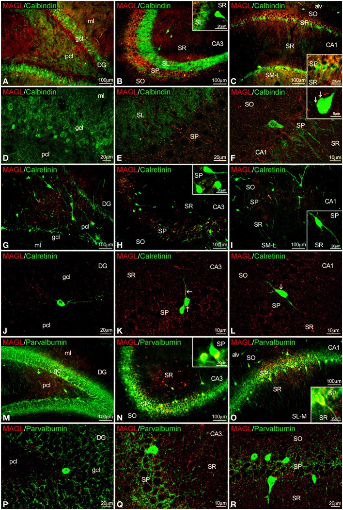 Co-localization of MAGL and calbindin, calretinin, or parvalbumin in the rat hippocampus. Low resolution epifluorescence photomicrographs (A–C,G–I,M–O) and high resolution confocal laser scanning photomicrographs (D–F,J–L,P–R) showing labeling for calbindin, calretinin, or parvalbumin (green) and MAGL (red) in dentate gyrus, CA3, and CA1 areas. Arrows indicate MAGL fiber terminals closely attached to cells expressing calbindin and calretinin, but not parvalbumin. For abbreviations see Figure 2. Scale bars are indicated in each image.