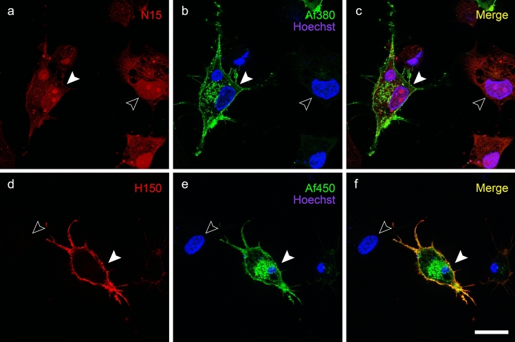 Live immunolabelling of in CB1-transfected HEK293 cells with N15 and H150 antibodies (pseudocoloured red), raised against the extracellular amino-terminal tail of CB1 receptor, followed by cell fixation–permeabilization and co-immunolabelling with Af380 (a–c) and Af450 (d–f) antibodies (pseudocoloured green), raised against the carboxy-terminus of CB1 receptor. Nuclei were counterstained using Hoechst nuclear stain. Single-channel images shown in a, b and d, e were merged together with Hoechst’s chromatin staining (shown in c and f, respectively). Micrographs are maximum intensity projections of three consecutive optical sections separated by 0.24 μm, obtained by structured illumination microscopy. Scale bar: 20 µm (applies to a–l)