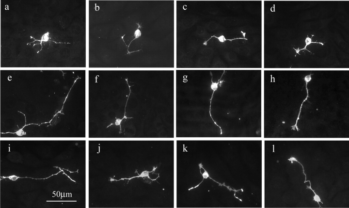 The effect of FGF2 and CB1 agonists on neuronal morphology. Cerebellar neurons were cultured overnight on 3T3 cell monolayers in control media (a–d) containing 5 ng/ml FGF2 (e–h) or media containing 0.2 μM WIN 55,212–2 (i–l) before being fixed and stained for GAP-43. Representative examples of neurite-bearing cells are shown.