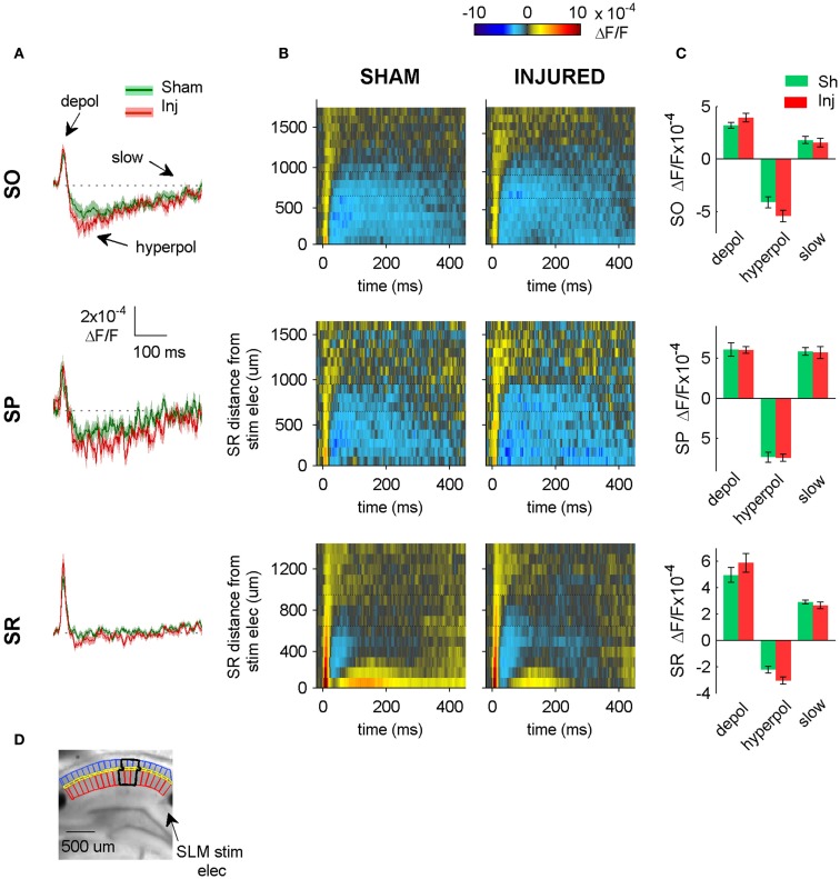 SLM-evoked responses in aCSF do not change after injury. (A) Group average regional VSD signals in SO (top panel), SP (middle panel), and SR (bottom panel) in response to SLM stimulation in aCSF. SLM-evoked hyperpolarization does not change significantly after injury (SO, P = 0.114; SP, P = 0.926; SR, P = 0.059 sham n = 13, injured n = 11). The absence of any significant change in the SR, SP, or SO responses to SLM stimulation suggests that inadvertent stimulation of SLM does not contribute significantly to SR-evoked SO hyperpolarization. (B) Raster plots also show no change in SP or SO hyperpolarization. Horizontal dotted lines on rasters indicate analysis region. (C) Group data shows no significant differences in the SO responses to SLM stimulation, although there was a moderate increase in SR hyperpolarization. (D) Photograph of representative slice depicting analysis region (black outline) and location of SLM stimulating electrode. Stimulus: 300 μA. Sham n = 13, injured n = 11. SO, stratum oriens; SR, stratum radiatum; SLM, stratum lacunosum-moleculare; depol, depolarization; hyperpol, hyperpolarization; stim elec, stimulating electrode.