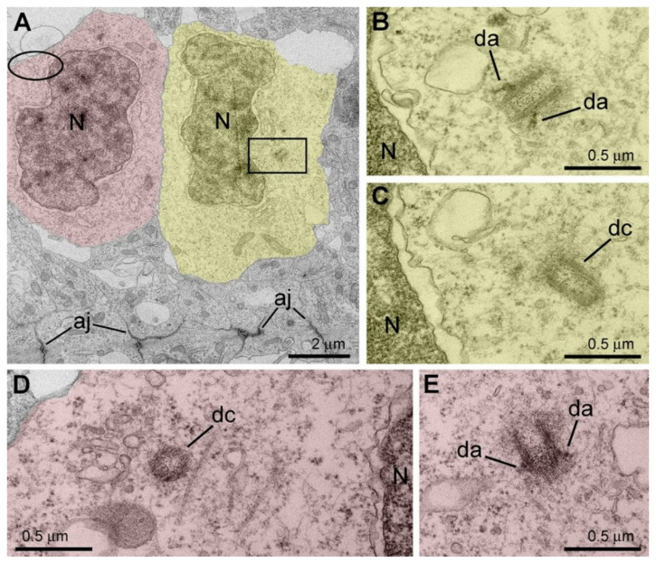 Electron microscopy analysis of an apical NPC in the cerebral ventricular zone from a 54-day-old rhesus macaque embryo. (A) Low-power micrograph shows two daughter cells shortly after mitosis (highlighted yellow and red). The rectangularly framed area is enlarged in serial sections (B,C) depicting both centrioles located free in cytoplasm. Ovoid in (A) indicates approximate position of centrosome in the other daughter cell shown in high-power serial not adjacent sections in (D,E). Both centrioles are free in cytoplasm. Distal appendages (da) identify mature mother centrioles. Abbreviations: aj, adherens junctions; dc, daughter centriole; da, distal appendage; N, nucleus. Modified from [94]. (License 6183791501210).