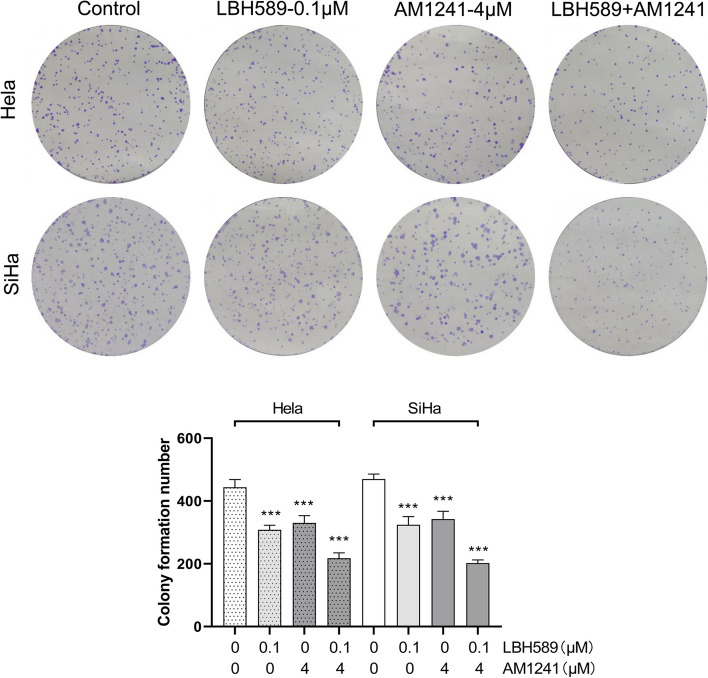 The effect of different concentrations of LBH589 or AM1241 on the proliferation of cervical cancer cells. The impact of LBH589 and AM1241, either alone or in conjunction, on the proliferation of HeLa and SiHa cells was assessed via colony formation assay (n = 3). Compared with 0 μM AM1241 + 0 μM LBH589, ***P < 0.001