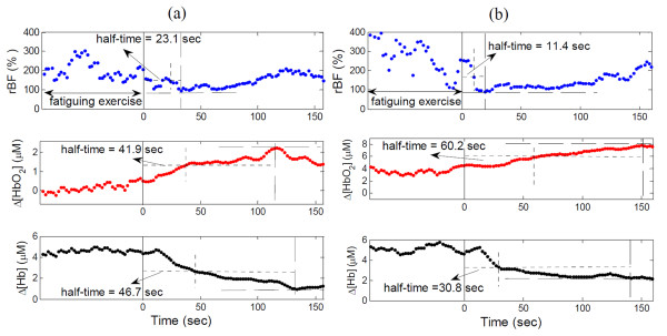 Illustrative recovery half-times of relative blood flow (rBF), change in oxyhemoglobin concentration (Δ[HbO2]) and change in deoxyhemoglobin concentration (Δ[Hb]) following fatiguing exercise in (a) a subject with fibromyalgia (FM) and (b) a healthy control. The vertical solid lines indicate the ending of exercise. The horizontal dashed and dotted lines indicate the maximal and half-maximal recovery values of hemodynamic variables, respectively. The vertical dotted lines indicate the recovery half-times.