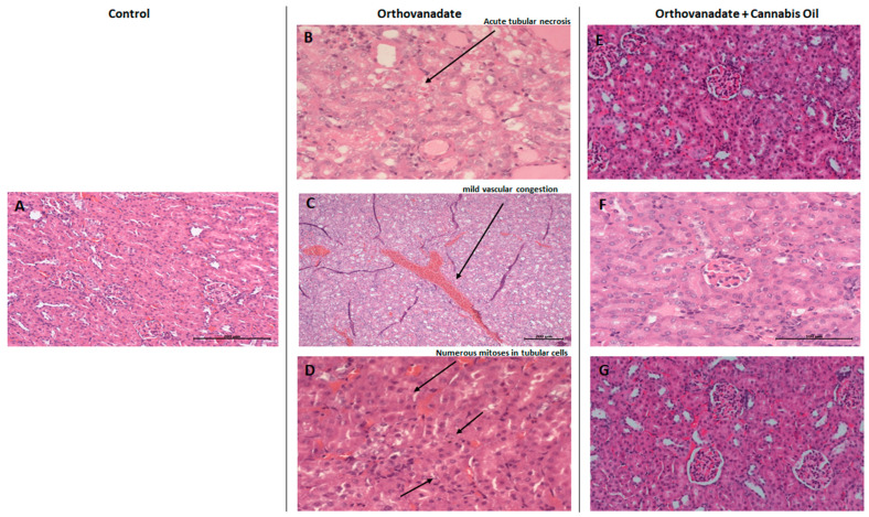 Micrograph of renal sections of rats from different groups (H&E stained). (A) Control rats showing renal parenchyma with no specific changes (enlargement: ×200); (B–D) sodium orthovanadate-treated rats demonstrating (B) acute tubular necrosis (enlargement: ×400), (C) renal parenchyma with mild vascular congestion (enlargement: ×100) (scale bar 200 µM: (C)), and (D) numerous mitoses in tubular cells (enlargement: ×400). Cannabis-treated rats at different doses—(E) 5 mg/kg (enlargement: ×200), (F) 10 mg/kg (enlargement: ×400), and (G) 20 mg/kg (enlargement: ×200)—showing renal parenchyma with no specific changes (scale bar 100 µM: (F)).