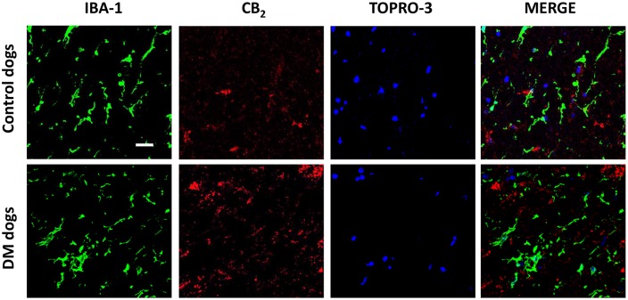 Double immunofluorescence analysis for CB2 receptor and Iba-1 in DM-affected dogs. Representative photomicrographs showing double immunofluorescence analysis for the CB2 receptor and Iba-1, using TOPRO-3 for labelling cell nuclei, in the grey matter of the ventral horn in T7-T10 spinal cord sections of DM-affected and age-matched control dogs (n=3/group). Scale bar: 50 µm.