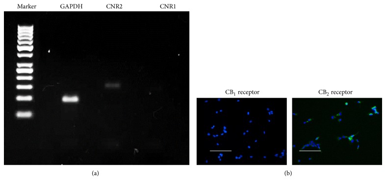 Expression of cannabinoid receptors 1 and 2 in BM-MSCs. (a) RT-PCR analysis of cannabinoid receptors (CNR) 1 and 2 genes in BM-MSCs. Expression of cannabinoid receptor 2 was confirmed in BM-MSCs. GAPDH was used as internal control. PCR products were resolved on 2% agarose gel. (b) Immunofluorescent staining was performed to detect expression of CNR1 and CNR2 in BM-MSC at protein level. Bar = 100 μm.