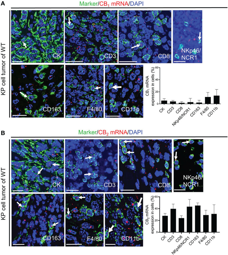 CB1 and CB2 mRNA in tumor cells and immune cells of the TME. (A, B) In situ hybridization (ISH)/immunofluorescence (IF) of tumor/immune cells in KP cell tumor sections from wild type mice. (A) The graph demonstrates the percentages of co-localization of CB1 mRNA positive signals with tumor cells (cytokeratin-stained, CK+ cells; ~ 5%) and leukocytes of the TME, such as CD3+ T cells (~ 4%), CD8+ T cells (~ 3%), NKp46/NCR1+ cells (natural killer, NK cells; ~ 14%), CD163+ M2 macrophages (~ 7%), F4/80+ M1 and M2 macrophages (~ 11%), and CD11b+ myeloid cells (~ 14%). (B) The graph shows the percentages of co-localization of CB2 mRNA signals with tumor cells (~ 25%) and tumor-infiltrating immune cells, including CD3+ T cells (~ 39%), CD8+ T cells (~ 24%), NKp46/NCR1+ NK cells (~ 43%), CD163+ M2 macrophages (~ 43%), F4/80+ M1 and M2 macrophages (~ 29%), and CD11b+ myeloid cells (~ 29%). Arrows denote CB1 or CB2 ISH mRNA signals within tumor and immune cells. Calibration bars=20 μm. Data indicate mean values +SD; n=3 (sections from three different tumors, 30-150 cells counted per section). TME, tumor microenvironment.